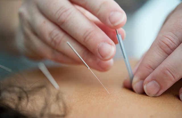 5 Best Acupuncture Clinics in Miami🥇 – Toppiest.com
